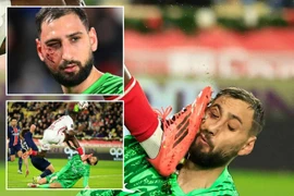 Chấn thương ghê rợn của thủ môn tuyển Italia
