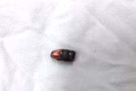 Súng bút nhặt được dưới suối lên phát nổ đạn ghim vào tay