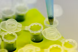 Phát hiện virus gây suy giảm nhận thức sống trong cổ họng người