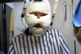 Cụ ông cuồng ghen cắt mũi, tai, môi người tình ném xuống toilet