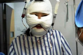 Cụ ông cuồng ghen cắt mũi, tai, môi người tình ném xuống toilet