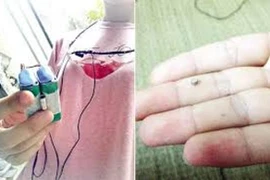 Thi THPT quốc gia: "Tuyệt chiêu" gian lận sử dụng tai nghe siêu nhỏ bằng hạt đậu