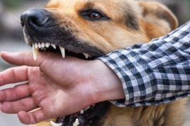 Hà Nội: Một người đàn ông ở trọ tại Long Biên tử vong sau 2 tháng bị chó cắn