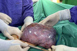 Phát hiện khối u lớn hơn một năm nhưng từ chối phẫu thuật, người phụ nữ nguy kịch