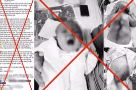 Cảnh báo các hoạt động kêu gọi gây quỹ từ thiện tại bệnh viện, ngăn ngừa trục lợi