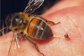 Đang ở trong nhà, bé gái 13 tuổi bị ong mật bay vào đốt gây sốc phản vệ nguy kịch