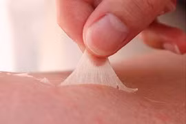 Bỏng da, rôm sảy do nắng nóng, bác sĩ khuyến cáo cách phòng tránh