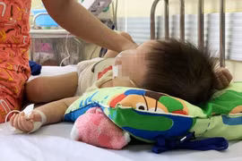 Số ca mắc sởi trên cả nước tăng 111 lần