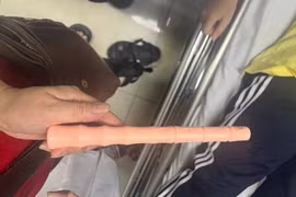 Nam sinh 19 tuổi bị mắc kẹt đồ chơi tình dục dài 30cm sâu trong hậu môn
