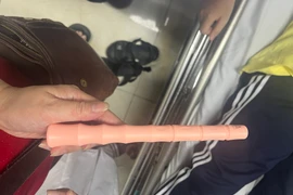 Nam sinh 19 tuổi bị mắc kẹt đồ chơi tình dục dài 30cm sâu trong hậu môn