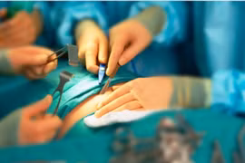 Thêm một trường hợp suýt mất dương vật do tai nạn trong sinh hoạt