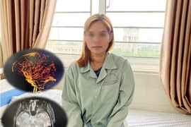 Cảnh báo nguy cơ đột quỵ não ở phụ nữ lạm dụng thuốc uống tránh thai