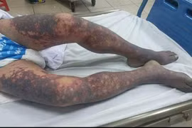 Người đàn ông 50 tuổi tử vong chỉ hơn 1 ngày sau khi giết lợn ăn tất niên 