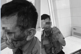 Nhân viên bảo vệ Bệnh viện K bị đối tượng chèo kéo người bệnh hành hung, khâu 8 mũi