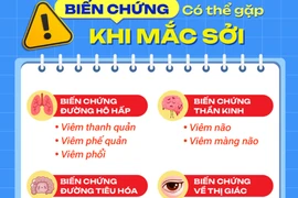 Bộ Y tế lập 6 đoàn kiểm tra địa phương tiêm chủng chậm, số mắc sởi cao