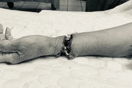 Nữ bệnh nhân 74 tuổi tự cắt đứt lìa cổ bàn tay trái, được cấp cứu và nối tay kịp thời