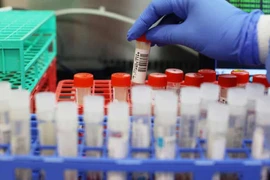 Cơ sở y tế không được bắt người bệnh tự mua que test Covid-19 hoặc trả phí xét nghiệm