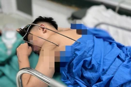 Cứu nam thanh niên 17 tuổi bị cây đinh ba tự chế đâm vào tim