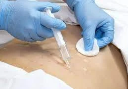 Nữ sinh lớp 11 ở Hà Nội giấu gia đình đi tiêm tan mỡ giảm béo, phải nhập viện vì biến chứng