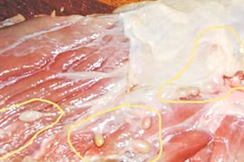 Hay ăn thịt bò tái, rau sống, một phụ nữ ở Hà Nội nhập viện vì mắc sán dây