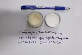 Cô gái nguy kịch vì dùng 5 hộp kem chống nám chứa hàm lượng thủy ngân vượt ngưỡng 4.000 lần