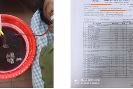 Mỗi ngày uống nửa lít rượu, người đàn ông 8 lần giãn vỡ tĩnh mạch, nhập viện vì nôn ra 1 lít máu...