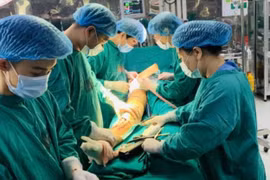 Mổ kết hợp ghép xương và chỉnh trục xương cho bệnh nhân đã phẫu thuật 6 tháng trước