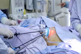 Lần đầu tiên nội soi 1 lỗ cắt tuyến vú điều trị ung thư kết hợp tạo hình thẩm mỹ ngực