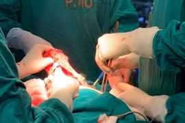 Bác sĩ nêu các dấu hiệu của ung thư vú, có thể điều trị hiệu quả nếu phát hiện sớm