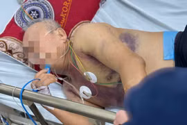 Cụ ông thập tử nhất sinh, mất đến một nửa lượng máu trong người vì sốt xuất huyết