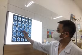 Tin mới vụ công nhân ở Bắc Ninh nhiễm độc methanol: 108 người nhập viện, có ca tử vong, mù mắt