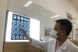 Tin mới vụ công nhân ở Bắc Ninh nhiễm độc methanol: 108 người nhập viện, có ca tử vong, mù mắt