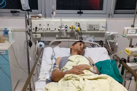 Bệnh nhân 52 tuổi bị biến chứng sốc tim nặng, ngừng tuần hoàn, được cứu sống thần kỳ