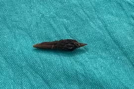 Người phụ nữ bị thủng ruột do nuốt hạt khi ăn yến chưng cùng táo đỏ