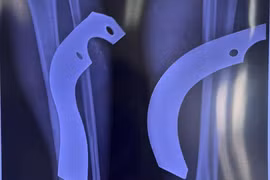 Người đàn ông ở Đông Anh bị lưỡi cày găm sâu vào chân, phải nhập viện cấp cứu