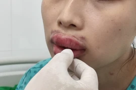 Nhập viện vì biến chứng do đi thẩm mỹ làm đẹp “cấp tốc” trước Tết