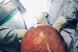 Bác sĩ ngỡ ngàng khi mổ cho bệnh nhân có u tử cung khổng lồ gần 10 kg, bụng như bà bầu