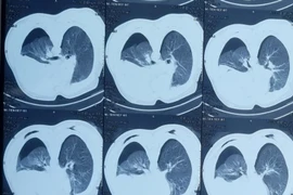 Hà Nội: Đang bán hàng, người đàn ông 44 tuổi bất ngờ bị đâm 3 nhát sau lưng xuyên thấu ngực