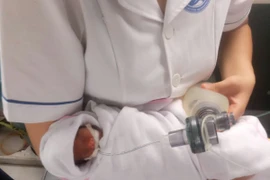 Kỳ tích: Cứu sống bé sinh non khi mới 26 tuần và nhẹ cân nhất từ trước đến nay