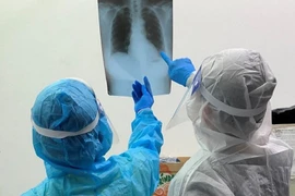 Thêm 18 bệnh nhân Covid-19 tử vong được công bố, một số nữa đang cập nhật