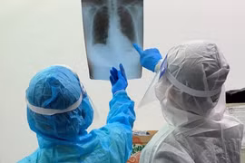 Thêm 18 bệnh nhân Covid-19 tử vong được công bố, một số nữa đang cập nhật