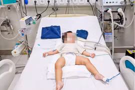 Tình trạng mới nhất của bé gái 18 tháng tuổi bị bạo hành tại Hà Nội: Có dấu hiệu chuyển biến khá hơn