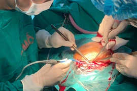 Ghép sọ bằng tấm titanium tạo hình 3D cho một nam sinh ở Hà Nội