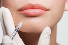 Những người trên 65 tuổi hạn chế tiêm botox 