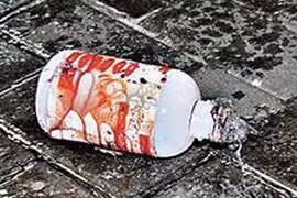 Án tù chung thân cho gã đàn ông tạt axít bé trai 12 tuổi