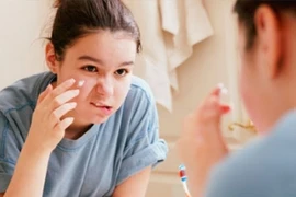 Tránh những yếu tố gây mụn trứng cá