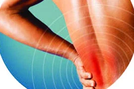 Đau thắt lưng, nguyên nhân hàng đầu gây liệt