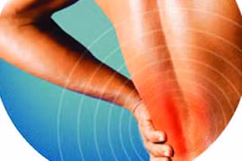 Đau thắt lưng, nguyên nhân hàng đầu gây liệt