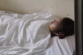 Tranh giành tài sản, chị chồng tạt axít em dâu 