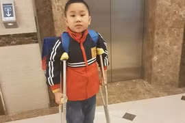 Đề nghị không khởi tố lái xe làm gãy chân học sinh, dù giám định thương tật 32%